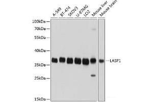 Western blot analysis of extracts of various cell lines using LASP1 Polyclonal Antibody at dilution of 1:1000. (LASP1 antibody)