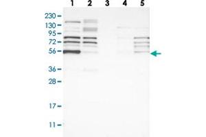 Western blot analysis of Lane 1: RT-4, Lane 2: U-251 MG, Lane 3: Human Plasma, Lane 4: Liver, Lane 5: Tonsil with WIPF2 polyclonal antibody  at 1:250-1:500 dilution. (WIPF2 antibody)