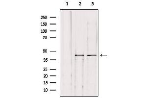 Western blot analysis of extracts from various samples, using KITH_HHV1S Antibody. (HHV-1 Thymidine Kinase antibody)