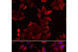 Immunofluorescence analysis of U2OS cells using PDLIM1 Polyclonal Antibody (PDLIM1 antibody)