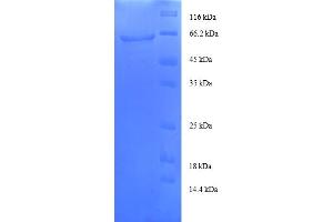 SDS-PAGE (SDS) image for Transaldolase 1 Pseudogene 1 (TALDO1P1) (AA 9-337), (partial) protein (GST tag) (ABIN5712345) (TALDO Protein (AA 9-337, partial) (GST tag))