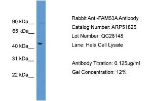 WB Suggested Anti-FAM53A  Antibody Titration: 0. (Fam53a antibody  (C-Term))