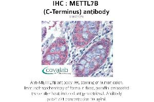 Image no. 1 for anti-Methyltransferase Like 7B (METTL7B) (C-Term) antibody (ABIN1736925)