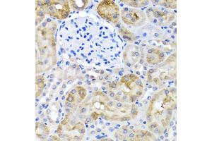 Immunohistochemistry of paraffin-embedded rat kidney using SULT1A1 antibody (ABIN5970776) at dilution of 1/100 (40x lens).