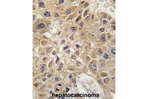 Immunohistochemistry (IHC) image for anti-Autocrine Motility Factor Receptor (AMFR) antibody (ABIN2995186) (AMFR antibody)