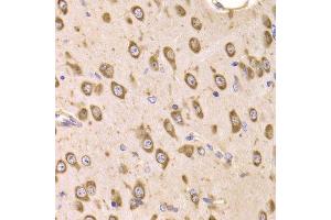 Immunohistochemistry (Paraffin-embedded Sections) (IHC (p)) image for anti-Eukaryotic Translation Elongation Factor 1 beta 2 (EEF1B2) (AA 1-225) antibody (ABIN6139949)