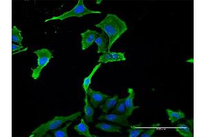 Immunofluorescence of monoclonal antibody to BNC1 on HeLa cell.
