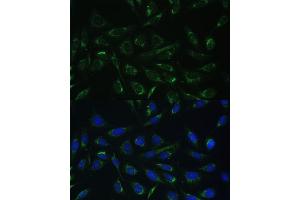 Immunofluorescence analysis of U-2 OS cells using HCCS Polyclonal Antibody (ABIN6129024, ABIN6141652, ABIN6141653 and ABIN6223386) at dilution of 1:100 (40x lens). (HCCS antibody  (AA 1-268))