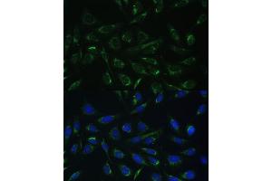 Immunofluorescence analysis of U-2 OS cells using HCCS Polyclonal Antibody (ABIN6129024, ABIN6141652, ABIN6141653 and ABIN6223386) at dilution of 1:100 (40x lens).