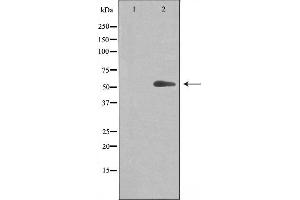Western blot analysis of extracts from Jurkat cells, using Cytochrome P450 20A1 antibody. (CYP20A1 antibody  (Internal Region))