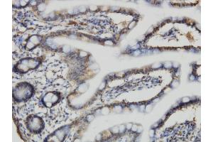 Immunoperoxidase of monoclonal antibody to ACBD3 on formalin-fixed paraffin-embedded human small Intestine. (ACBD3 antibody  (AA 73-171))