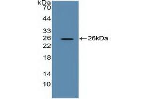 Figure. (EEF2 antibody  (AA 32-233))