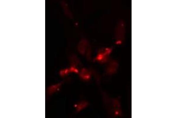 NUP160 antibody  (Internal Region)