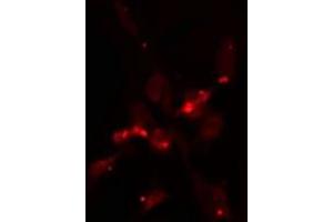 ABIN6275316 staining  NIH-3T3 cells by IF/ICC. (NUP160 antibody  (Internal Region))