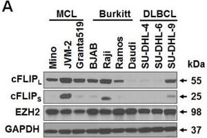 Western Blotting (WB) image for anti-Glyceraldehyde-3-Phosphate Dehydrogenase (GAPDH) antibody (ABIN2857072)