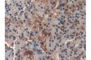 Detection of DLD in Rat Adrenal gland Tissue using Polyclonal Antibody to Dihydrolipoyl Dehydrogenase (DLD)