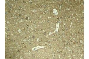 Immunohistochemical analysis of paraffin-embedded rat hippocampal region tissue from a model with Alzheimer (MAPT antibody  (pSer404))