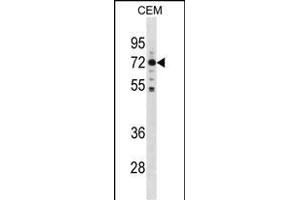 K Antibody (C-term) (ABIN1881520 and ABIN2838969) western blot analysis in CEM cell line lysates (35 μg/lane).