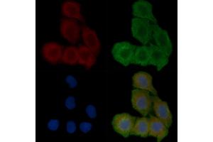 ABIN6258230 and ABIN6273626 staining Hela cells(30 min of UV treatment) by IF/ICC.