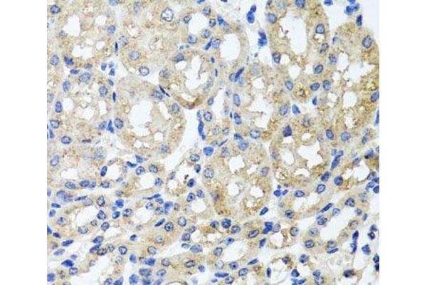ST8SIA2 antibody