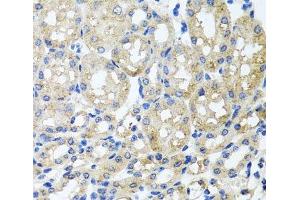Immunohistochemistry of paraffin-embedded Mouse kidney using ST8SIA2 Polyclonal Antibody at dilution of 1:100 (40x lens). (ST8SIA2 antibody)