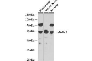 Western blot analysis of extracts of various cell lines, using M antibody  at 1:1000 dilution. (Matrilin 3 antibody  (AA 277-486))