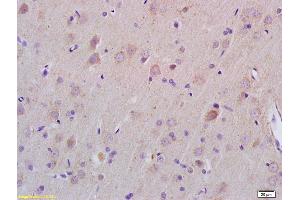 Formalin-fixed and paraffin embedded rat brain labeled with Rabbit Anti ZDHHC21 Polyclonal Antibody, Unconjugated (ABIN705566) at 1:200 followed by conjugation to the secondary antibody and DAB staining