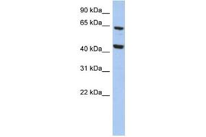 WB Suggested Anti-EFHA2 Antibody Titration: 0. (EFHA2 antibody  (N-Term))