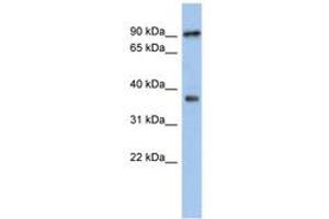 Image no. 1 for anti-Radial Spoke Head 10 Homolog B (RSPH10B) (AA 287-336) antibody (ABIN6743957) (RSPH10B antibody  (AA 287-336))