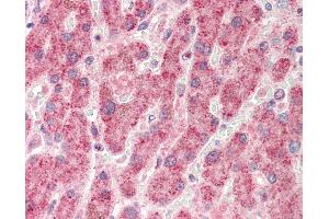 Human, Liver: Formalin-Fixed Paraffin-Embedded (FFPE). (NUDC antibody  (AA 124-173))