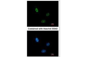 ICC/IF Image Immunofluorescence analysis of paraformaldehyde-fixed HeLa, using CLP1, antibody at 1:200 dilution. (CLP1 antibody  (Center))