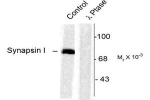 Image no. 2 for anti-Synapsin I (SYN1) (pSer603) antibody (ABIN227585)