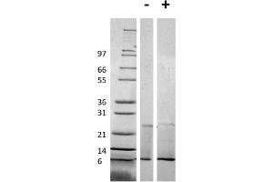 SDS-PAGE of Mouse RELM alpha Recombinant Protein SDS-PAGE of Mouse RELM alpha Recombinant Protein. (RELM alpha Protein)