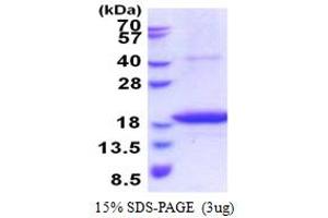SDS-PAGE (SDS) image for STEAP Family Member 4 (STEAP4) (AA 1-152) protein (His tag) (ABIN5853589) (STEAP4 Protein (AA 1-152) (His tag))