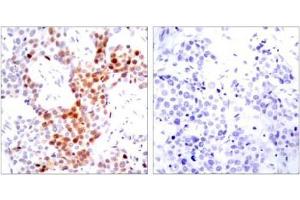 Image no. 1 for anti-Activating Transcription Factor 2 (ATF2) (pThr51), (pThr69) antibody (ABIN196664) (ATF2 antibody  (pThr51, pThr69))