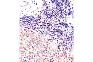 (ABIN6242141 and ABIN6578005) staining (Mouse) Suz12 in mouse spleen sections by Immunohistochemistry (IHC-P - paraformaldehyde-fixed, paraffin-embedded sections). (SUZ12 antibody  (AA 381-395))