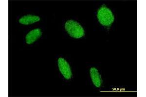 Immunofluorescence of monoclonal antibody to FLI1 on HeLa cell. (FLI1 antibody  (AA 1-452))