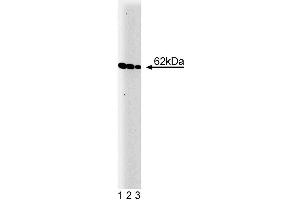 Western blot analysis of Yes on a A431 cell lysate (Human epithelial carcinoma, ATCC CRL-1555). (YES1 antibody  (AA 10-193))