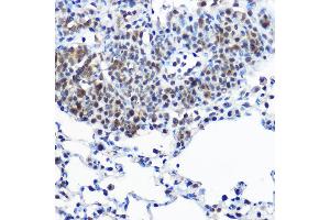 Immunohistochemistry of paraffin-embedded rat lung using Casein Kinase 2 beta (Casein Kinase 2 beta (CSNK2B)) Rabbit pAb  at dilution of 1:100 (40x lens). (CSNK2B antibody  (AA 1-215))