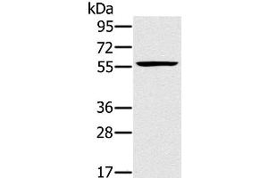 Western Blot analysis of Jurkat cell using TRIM34 Polyclonal Antibody at dilution of 1:250 (TRIM34 antibody)