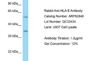 Western Blotting (WB) image for anti-HLA Class I Histocompatibility Antigen, alpha Chain E (HLA-E) (Middle Region) antibody (ABIN2789267) (HLA-E antibody  (Middle Region))