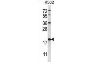 Western Blotting (WB) image for anti-Glutathione S-Transferase mu 5 (GSTM5) antibody (ABIN2996912)