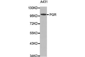 Western blot analysis of extracts of A431 cell lines, using PGR antibody. (Progesterone Receptor antibody  (C-Term))