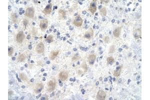 Rabbit Anti-YEATS4 antibody        Paraffin Embedded Tissue:  Human Brain cell   Cellular Data:  Epithelial cells of renal tubule  Antibody Concentration:   4. (GAS41 antibody  (Middle Region))