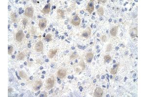 Rabbit Anti-YEATS4 antibody        Paraffin Embedded Tissue:  Human Brain cell   Cellular Data:  Epithelial cells of renal tubule  Antibody Concentration:   4. (GAS41 antibody  (Middle Region))