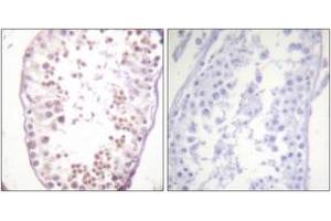 Immunohistochemistry analysis of paraffin-embedded human testis, using HDAC6 (Phospho-Ser22) Antibody. (HDAC6 antibody  (pSer22))