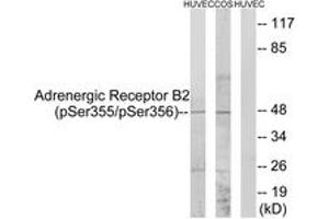 Western Blotting (WB) image for anti-Adrenergic, beta-2-, Receptor, Surface (ADRB2) (AA 331-380), (pSer355) antibody (ABIN1531482)