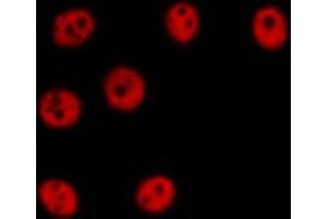 ABIN6274357 staining HepG2 cells by IF/ICC. (ZNF638 antibody  (Internal Region))