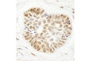Immunohistochemistry (IHC) image for anti-WD Repeat Containing, Antisense To TP53 (WRAP53) (AA 1-50) antibody (ABIN7448864)