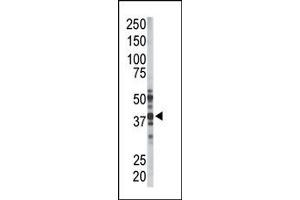 Image no. 1 for anti-Palmitoyl-Protein Thioesterase 1 (PPT1) (N-Term) antibody (ABIN357783) (PPT1 antibody  (N-Term))